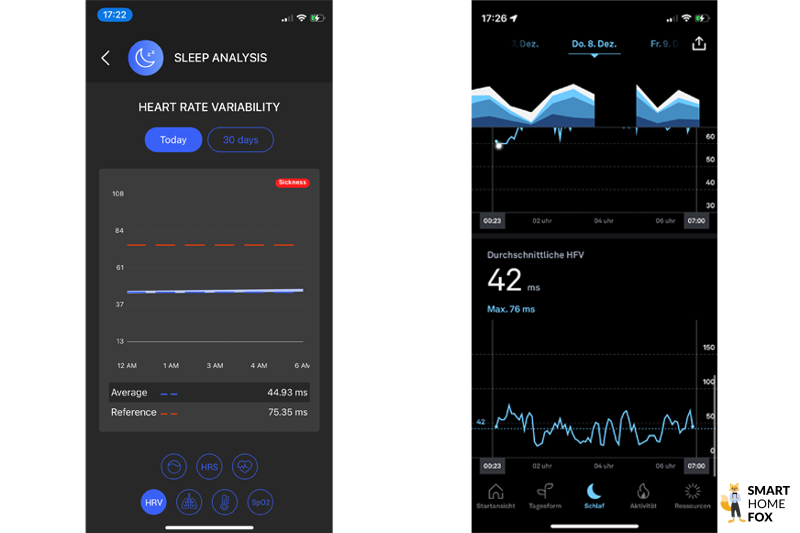 circular ring comparatif variabilite cardiaque